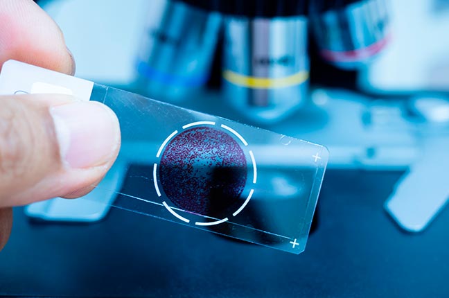 vidro de microscópio para patologia