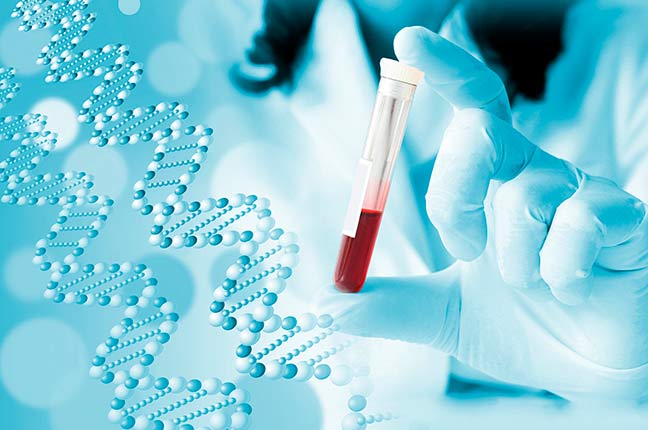 tudo de ensaio para exame de sangue