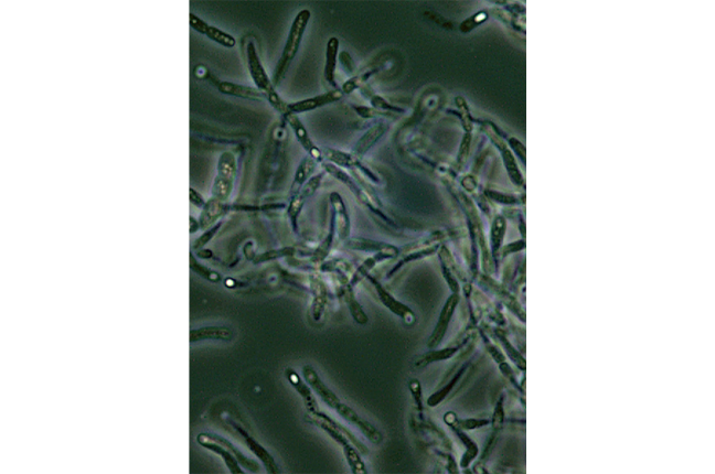 fotomicrografia usando a técnica de microscopia de contraste de fases